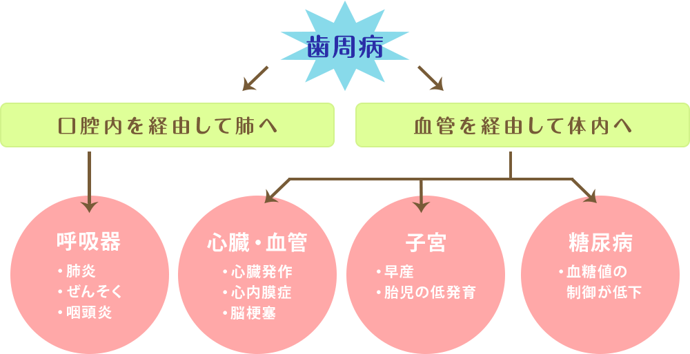 歯周病は全身にかかわる恐ろしい病気・・・